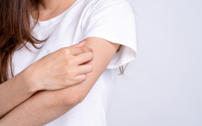 Eczema: Finding the root cause and providing natural treatments for symptom relief